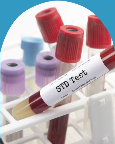 STD Testing in Chicago, IL STD Testing in Chicago, IL